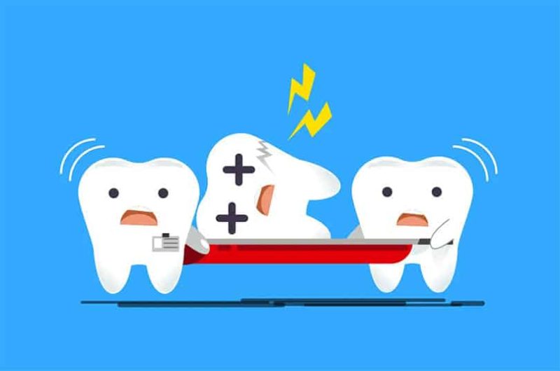 How To Handle Common Dental Emergencies