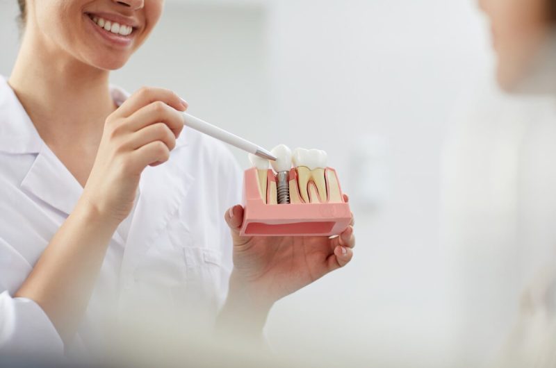 Dental Implants — Your Best Option For Replacing Teeth