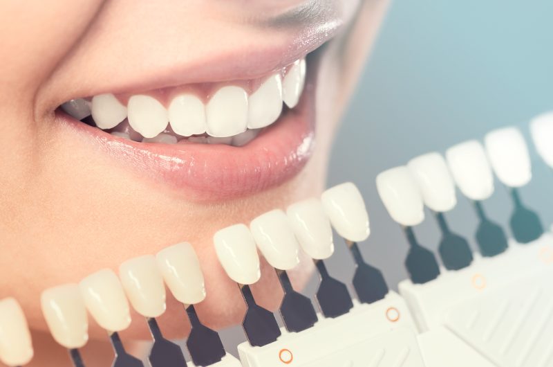 The Complete Guide To Cosmetic Dentistry