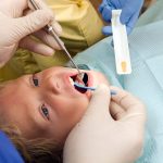 Fluoride Varnish Helps Prevent Tooth Decay