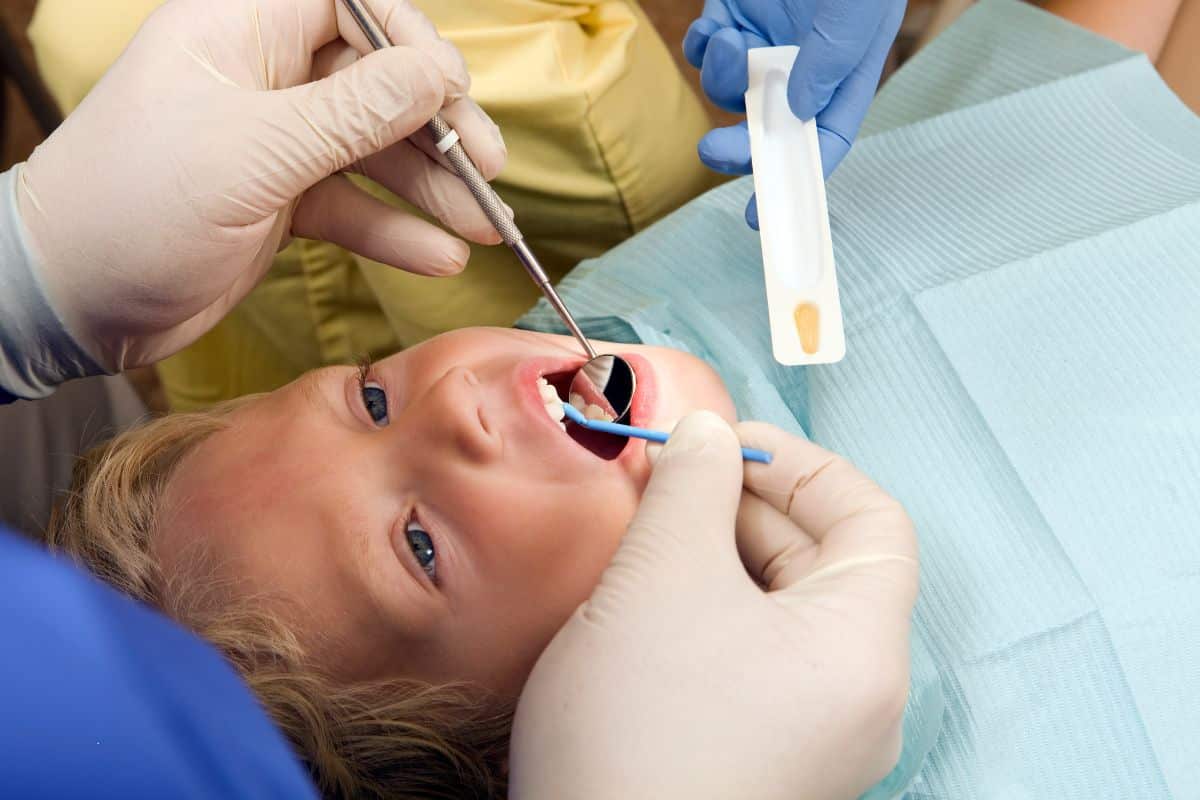 Fluoride Varnish Helps Prevent Tooth Decay