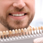 How Long It Will Take To Whiten Teeth