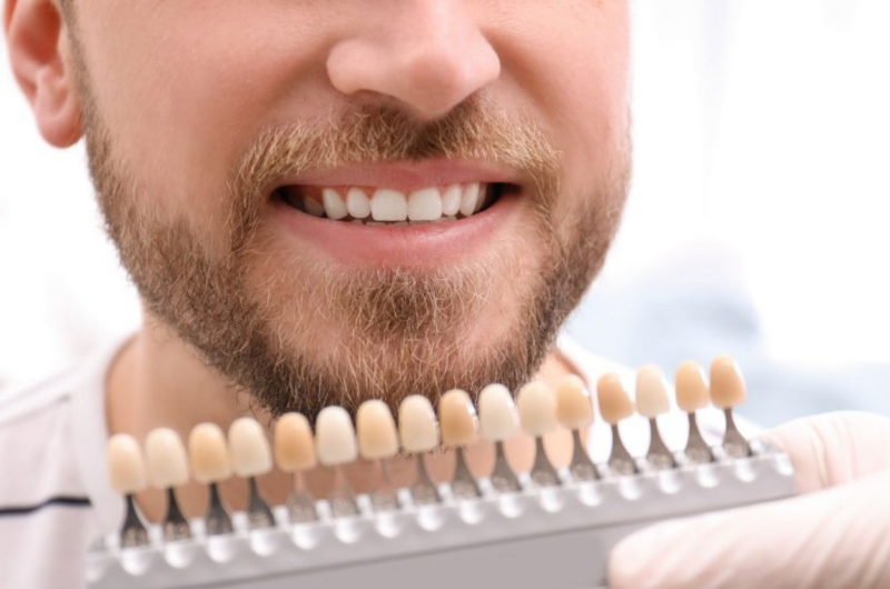 How Long It Will Take To Whiten Teeth