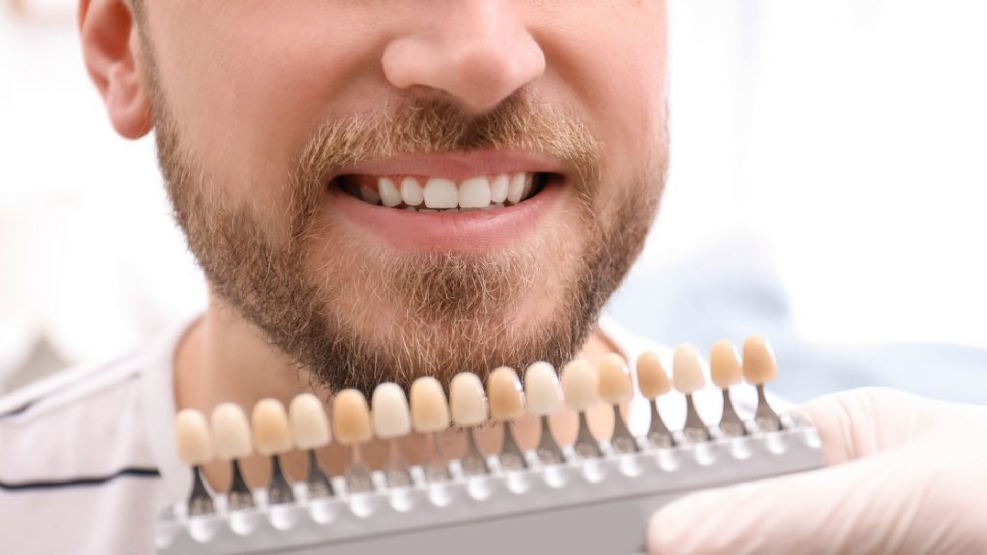 How Long It Will Take To Whiten Teeth