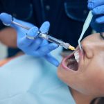 Pain-Free Dentistry With Local Anesthesia