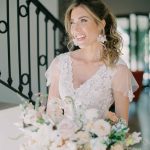 Planning Your Wedding Day Smile – Smile Makeover