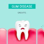 Prevention of Gum Diseases