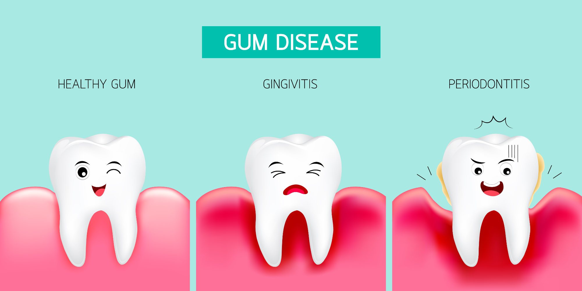 Prevention of Gum Diseases