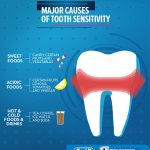 Treatment Of Tooth Sensitivity