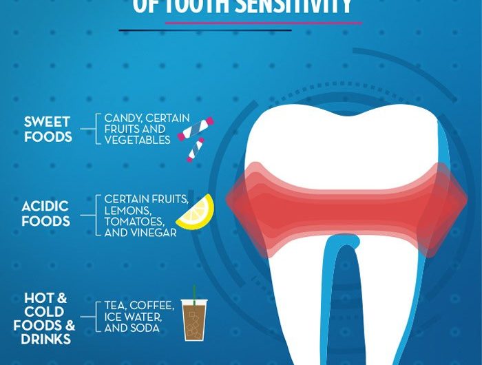 Treatment Of Tooth Sensitivity