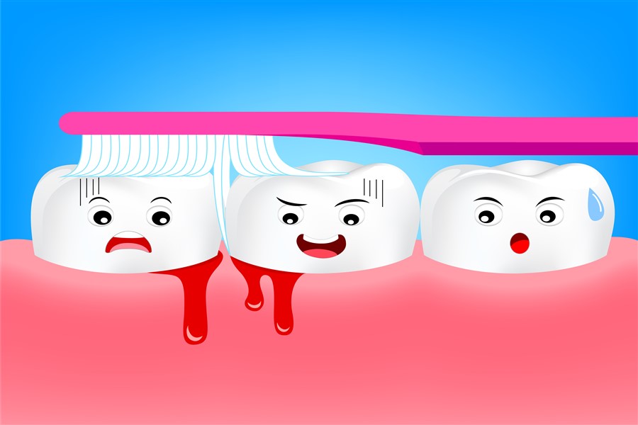 prevention of gum disease